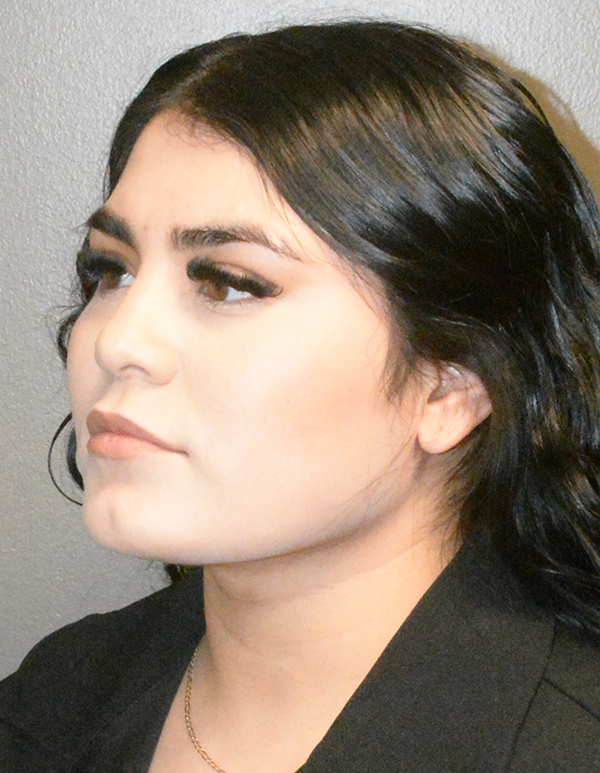 Chin and Jawline Liposuction