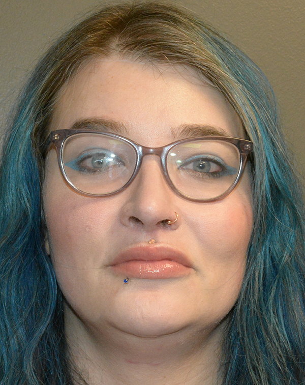 Lip Lift