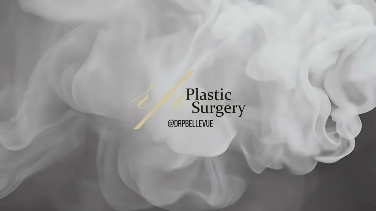 Chin implant Chin Augmentation by Dr. Parikh at RP Plastic Surgery Center