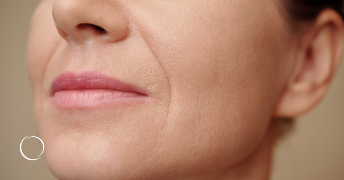 fat based fillers